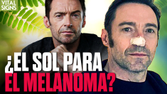 El sol: ¿aliado o enemigo en la lucha contra el melanoma?