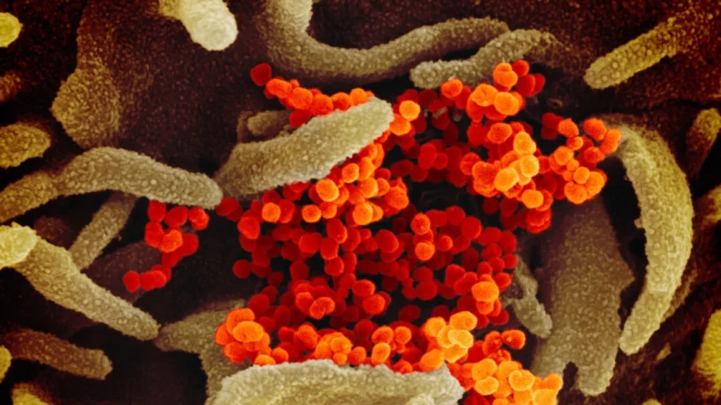 Esta imagen tomada con un microscopio electrónico de barrido muestra el nuevo coronavirus (naranja), causante de la enfermedad COVID-19, aislado de un paciente en los Estados Unidos, emergiendo de la superficie de células (verde) cultivadas en el laboratorio. Foto publicada el 13 de febrero de 2020. NIAID-RML

