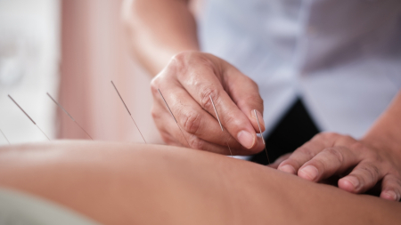 Científicamente probado: la acupuntura alivia de forma eficaz, segura y duradera el dolor lumbar