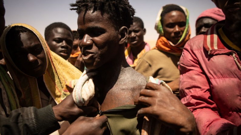 Un migrante se expone la piel, mostrando signos de sarna, mientras se une a otros manifestantes en Assamaka, Níger, el 29 de marzo de 2023. Cada semana, cientos de migrantes devueltos desde Argelia quedan varados en Assamaka, la primera aldea en la frontera con Níger. Malienses, guineanos, marfileños, sirios y bangladesíes habían caminado 15 km por el desierto. (Foto de STANISLAS POYET / AFP) (Foto de STANISLAS POYET/AFP vía Getty Images)